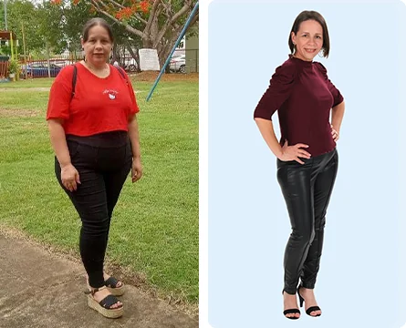 Yadira before and after weight loss