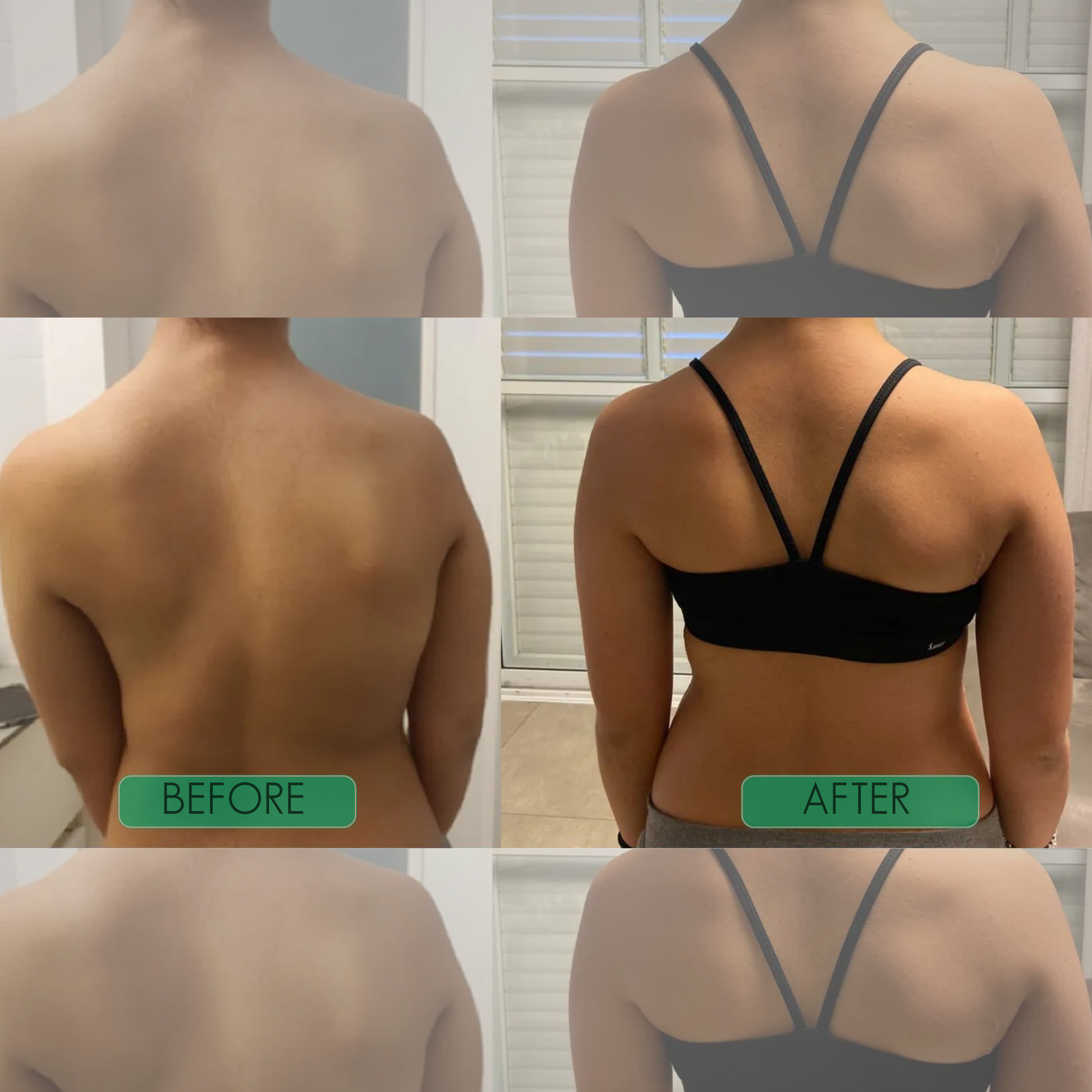 Instant Posture Corrector Corecare